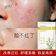 洋甘菊醫(yī)用補(bǔ)水面膜舒緩修護(hù)敏感肌面膜保濕美白淡斑舒緩改善舒緩 一盒 10片