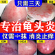 龜頭炎專(zhuān)用藥龜頭炎私處真菌感染性病hpv男士專(zhuān)用藥包皮炎紅點(diǎn)消炎止癢曲咪新乳膏男科皮膚用藥 1盒【龜頭瘙癢】醫用龜頭炎藥膏