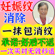華林堂孕婦油預防去妊娠紋橄欖油孕婦祛掉疤痕專(zhuān)用產(chǎn)后修復霜妊娠紋修復產(chǎn)后去除消除緊致肚皮生長(cháng)紋肥胖紋去除醫用修復大腿青年專(zhuān)用凝膠 單支【100%多買(mǎi)多送】妊娠紋專(zhuān)用