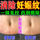 妊娠紋修復(fù)霜產(chǎn)后去除消除緊致肚皮淡化生長紋孕婦預(yù)防專用膏藥油 一盒裝【多買多送】熱銷榜第一