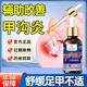 甲溝炎用膏藥甲溝炎藥液甲溝炎滴液嵌甲藥膏消腫長(cháng)緩解痛肉芽藥膏治療嚴重 1瓶體驗裝【30ml】