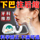 下巴后縮矯正器成人兒童張嘴呼吸牽引器改善牙齒嘴凸地包天縮頜墊 成人【輕度 牙套偏軟】牙科推薦