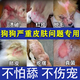 狗狗皮膚毛病專(zhuān)用狗癬真菌感染潰爛狗蘚狗狗皮膚毛病噴劑真菌感染脫毛抑菌噴劑皮炎螨蟲(chóng)掉毛細菌感染紅癢噴霧 3盒裝【300ml僅需2瓶錢(qián)】
