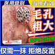 阿達帕林凝膠改善毛孔粗大去黑頭醫用祛痘消炎痤瘡專(zhuān)用青少年收縮毛孔粗大修復細致醫用深層清潔粉刺堵塞 1盒【閉口粉刺黑頭】