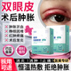 醫續美雙眼皮術(shù)后熱敷眼罩蒸汽消腫醫用術(shù)后貼麥粒腫眼貼緩解眼疲勞用BD 【單盒裝】雙眼皮術(shù)后消腫熱敷眼罩