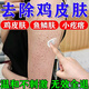 雞皮膚去除神器去雞皮膚毛囊角質(zhì)疙瘩大腿胳膊皮膚干燥兒童身體乳 單盒裝【雞皮膚克星】