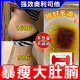 奧利司他膠囊排油減肥正品國(guó)藥準(zhǔn)字otc國(guó)家認(rèn)證減肥藥減肥瘦肚子燃脂服用7天大肚子全身快速瘦賽樂賽奧利司他 2盒裝【瘦大肚腩】