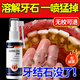 Moihanr德國去牙結石專(zhuān)用清理神器去口臭去牙漬煙漬溶解液搭牙膏漱口水