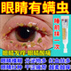 [恒久遠]鹽酸金霉素眼膏 0.5%*2g 3支裝 眼睛除螨蟲(chóng)藥治眼睛有螨蟲(chóng)睫毛根癢眼角癢緩解疲勞鹽酸金霉素眼膏 眼皮瘙癢 干癢痛