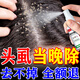 優(yōu)美加虱子藥兒童頭虱人用頭發(fā)虱立凈去除小孩頭上長(zhǎng)虱子虱卵一掃光專用 1盒裝【頭虱一噴凈】