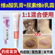 維a酸乳膏臉上面部尋常痤瘡藥膏 角化異常 雞皮膚用藥 維a酸外用otc非處方軟膏 2件套】維a酸乳膏+尿素維e乳霜 雞皮膚關(guān)節黑