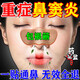 修正紅外鼻敏貼鼻炎貼遠紅外過(guò)敏性鼻塞鼻竇炎鼻子癢流鼻涕治療藥 【1盒不建議】貴在運費 【修正鼻敏貼】鼻炎專(zhuān)用膏藥