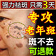 老年斑專(zhuān)用的藥水祛斑霜美白淡化老年黃褐雀斑黑色素去斑效果最好 1盒醫用級正品煙酰胺I精華