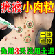 百易方去i疣體扁平疣絲狀疣專(zhuān)用瘊子猴子(非藥膏)脫落膏hpv祛疣神器凝膠 一盒【除疣凝膠】 頸部疣瘊靈去除脖子小肉粒尤