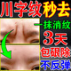 秋雅奈緒川字紋去除神器男女去重度抬頭紋皺紋法令紋提拉緊致懸紋祛除藥膏 【多數顧客選擇】買(mǎi)2送1