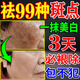 祛斑霜美白淡化老年黃褐雀斑去除黑色素男士醫(yī)用點斑專用正品藥水 一夜消【一支裝曬斑女士用的 100%祛斑效果最好的產(chǎn)品