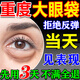 碧素堂眼袋貼去眼袋消除重度嚴重中老年男女專用淡化細紋黑眼圈去除神器 一盒裝【眼袋去除神器】