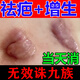 福隆藤原祛疤痕修復凝膠醫院專(zhuān)用醫用去疤膏手術(shù)疤增生凸起修復去除疙瘩 1盒裝【去除疤痕痘印】