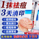 阿達帕林凝膠醫用祛痘消炎痤瘡專(zhuān)用青少年 粉刺痤瘡痘痘特新效藥痘印淡化消除男生去痘印痘疤祛痘祛青春痘 1盒【臉上起粉刺】 國藥準字 現貨速發(fā)