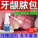 鄒潤安牙齦腫痛鼓包化膿牙齦膿包腫包腫痛發(fā)炎噴霧牙周膿腫口腔上火出血 京自倉100%特效發(fā)貨【一盒裝】 牙齦膿包腫痛消炎牙根發(fā)炎息肉增生周炎噴霧