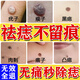 安井川藥業(yè)去痣點(diǎn)痣膏藥水正品無(wú)痛無(wú)痕專(zhuān)用臉部不留疤祛黑痣肉粒疣猴兒童 特效點(diǎn)痣1盒【無(wú)痛無(wú)痕去痣】