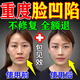 臻羞臉部凹陷填充液膠原蛋白太陽穴淚溝臉頰豐臉填充神器面部修復精華 1盒裝【微變化不明顯】
