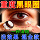 山本星奈眼霜黑眼圈重度去除祛黑色素男女士熬夜專(zhuān)用醫用淡化細紋提拉緊致 藥霜單盒裝【快速去黑眼圈】 日本進(jìn)口祛除眼部黑色素沉淀