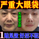 金力康眼袋貼祛眼袋消除重度嚴重中老年男女士專(zhuān)用去眼紋神器霜膠原蛋白 1盒體驗裝【發(fā)貨特效快】 眼貼膜去眼袋去眼紋膠原蛋白輔助治眼袋官方正品