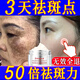 南京同仁堂【3天0斑點(diǎn)】正品美白祛斑霜淡化黑色素去老年斑黃褐斑雀斑男女士 1瓶裝 【各種膚質(zhì)均可使用】