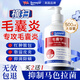 Sunoyar毛囊炎洗發(fā)水頭皮癢止癢頭部脂溢性皮炎醫(yī)用專(zhuān)用馬拉色菌抗真菌