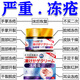 日本進(jìn)口凍瘡膏止癢凍傷膏凍瘡膏藥成人凍耳朵止癢防凍裂凍瘡神器 買(mǎi)2送1【特效療程裝】
