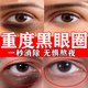 黑眼圈重度去除黑色素黑眼圈去除男士女士去黑眼圈專(zhuān)用眼部黑色素沉淀眼霜淡化細紋提拉緊致黑眼圈紅霉素眼膏 1盒【黑眼圈去除黑色素】早用早好