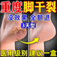 明威中草堂腳裂膏腳后跟干裂開(kāi)裂真菌感染專(zhuān)用秋冬手足干燥脫皮皸裂龜裂藥膏 拍1發(fā)5【開(kāi)裂凍瘡/徹底愈合】