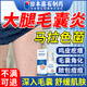 藤石制藥腿部毛囊炎專(zhuān)用噴劑馬拉色球菌毛囊角化長(cháng)疙瘩膿包皮膚藥監備案AZ【買(mǎi)二送一】腿上痘痘雞皮膚