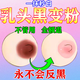 乳頭乳暈粉嫩百膚美改善乳頭私密處淡化產(chǎn)后發(fā)黑去黑色素沉淀專(zhuān)用 一盒裝【物流超快】