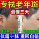 維a酸乳膏去老年斑專(zhuān)用藥特效一夜非消男士祛斑專(zhuān)用霜強力祛除手背部臉部去老人斑去黃褐斑專(zhuān)用藥 1盒【祛斑老年斑專(zhuān)用特效非藥一夜消】