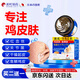 淞町制藥雞皮膚去除神器去除雞皮膚身體毛囊角質(zhì)疙瘩大腿角化癥專(zhuān)用非膏藥