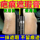強力疤痕修復紋身遮瑕膏凹陷疤痕紋身痘印手臂傷疤遮蓋神器防水 自然色【體驗裝】