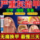 灰指甲專(zhuān)用藥【發(fā)貨特效快】特專(zhuān)用效藥指甲真菌感染脫甲壞甲增厚重度灰指甲涂搽劑皮膚用藥環(huán)吡酮胺乳膏 3盒【中度灰指甲增厚分層】