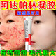 花容美阿達(dá)帕林凝膠醫(yī)用祛痘消炎痤瘡專用青少年0.3改善毛孔粗大去黑頭醫(yī)用正品膠美麗芙 1盒【阿達(dá)帕林凝膠醫(yī)用祛痘消炎】