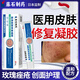 藤石制藥醫用玫瑰痤瘡專(zhuān)用修復凝膠皮膚屏障受損敏感肌泛紅面霜護膚品膏XT 3盒療程裝【第3盒0元】面部玫瑰痤瘡