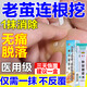 去腳底老繭去硬皮老繭去除去根水楊酸軟膏去腳底老繭去硬皮雞眼膏去貼根肉刺藥膏無(wú)痛脫落連根拔去老繭特的效 1盒【去老繭的特用藥】醫用級 無(wú)痛脫落