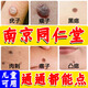 南京同仁堂點(diǎn)痣膏美容院專(zhuān)用去痣膏去黑痣臉部不留疤去痣專(zhuān)用中藥臉部黑點(diǎn)臉 點(diǎn)痣膏+點(diǎn)痣修護液套裝80客戶(hù)選