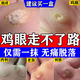水楊酸軟膏軟化角質(zhì)雞眼膏去好根肉刺藥膏無(wú)痛脫落連根拔雞眼去除特強效藥跖疣專(zhuān)用藥去腳底老繭去硬皮 1盒【醫用雞眼膏】早用不受罪