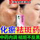 祛斑專用藥祛斑內(nèi)調(diào)中藥 化瘀祛斑膠囊內(nèi)調(diào)黃褐斑官方艦旗 黃褐斑內(nèi)調(diào)口服臉上長斑用【本店第一視覺特效】 5盒【嚴重色斑 鞏固裝】