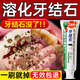 HIEUAILR德國(guó)牙結(jié)石牙膏去口臭去黃去牙漬去煙漬牙垢去除器清理神器溶解液 【拒絕牙結(jié)I石反復(fù)】?jī)珊兄芷谘b
