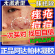 阿達帕林凝膠醫用祛痘消炎痤瘡專(zhuān)用青少年祛痘藥膏祛痘印修復淡化消除痘印痘坑硬疙瘩改善毛孔粗大去黑頭醫用 1盒【祛痘痘痘印專(zhuān)用藥膏】