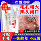 阿達帕林凝膠改善毛孔粗大去黑頭醫用祛痘消炎痤瘡專(zhuān)用青少年收縮毛孔粗大修復細致醫用深層清潔粉刺堵塞 1盒【皮膚用藥 非處方藥】