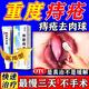 痔瘡膏去肉球內(nèi)外混合痔瘡專用藥痔瘡藥去肉球斷球根痔根源斷止癢肛門瘙癢痣痔藥消腫醫(yī)用凝膠熊膽痔靈膏 一盒【消痔專用 最好買多盒】