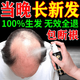 人仁生發(fā)劑快速生發(fā)男士防脫洗發(fā)水生發(fā)液激活毛囊育發(fā)增發(fā)密發(fā)長(zhǎng)發(fā)劑 單盒【體驗(yàn)裝】